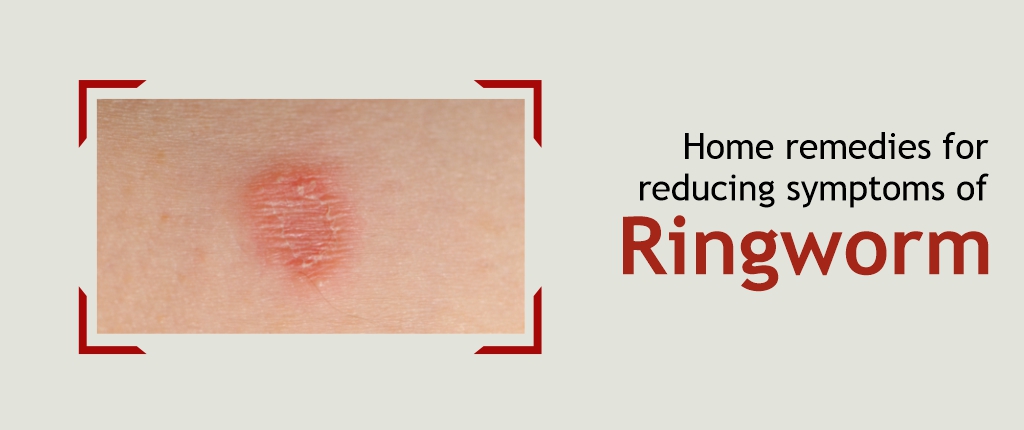 <strong>Home Remedies that can help reduce Symptoms of Ringworm!</strong>